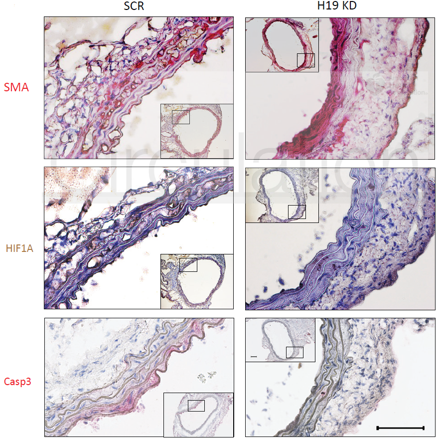 科研集市-19丨一文带你了解lncRNA与蛋白及核酸互作的功能机制研究