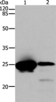 Anti-CBX5 antibody