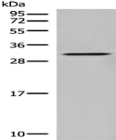 Anti-DNASE1L1 antibody