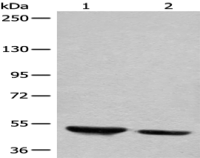 Anti-DENND1B antibody