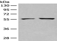 Anti-SELENBP1 antibody