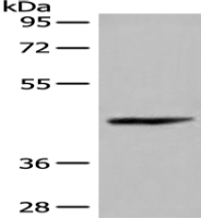 Anti-C11orf49 antibody