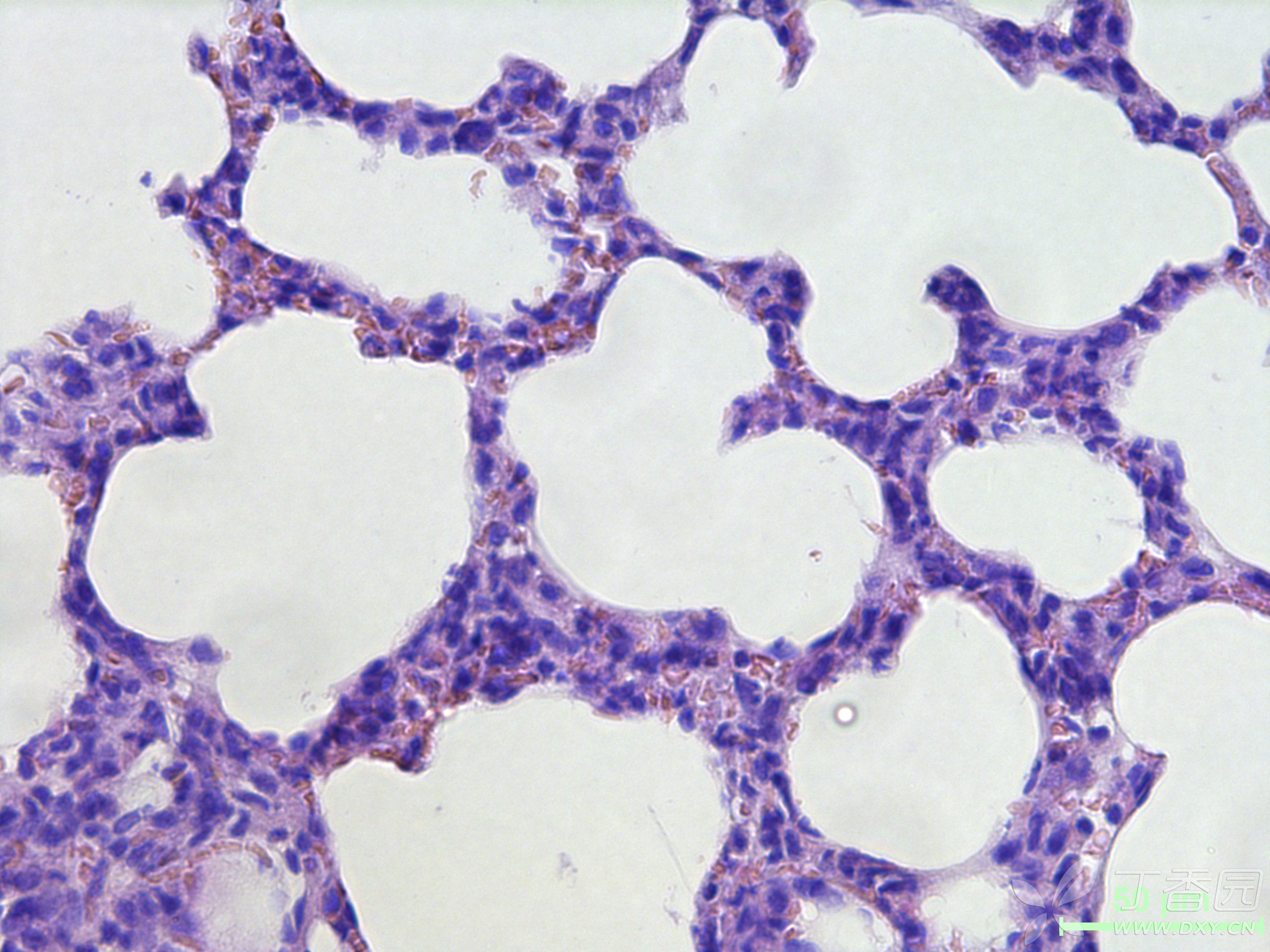 如何区分肺泡上皮细胞与炎症细胞?