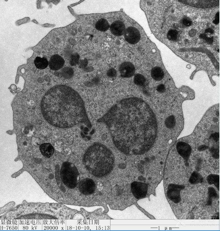 apoptosis小体图片