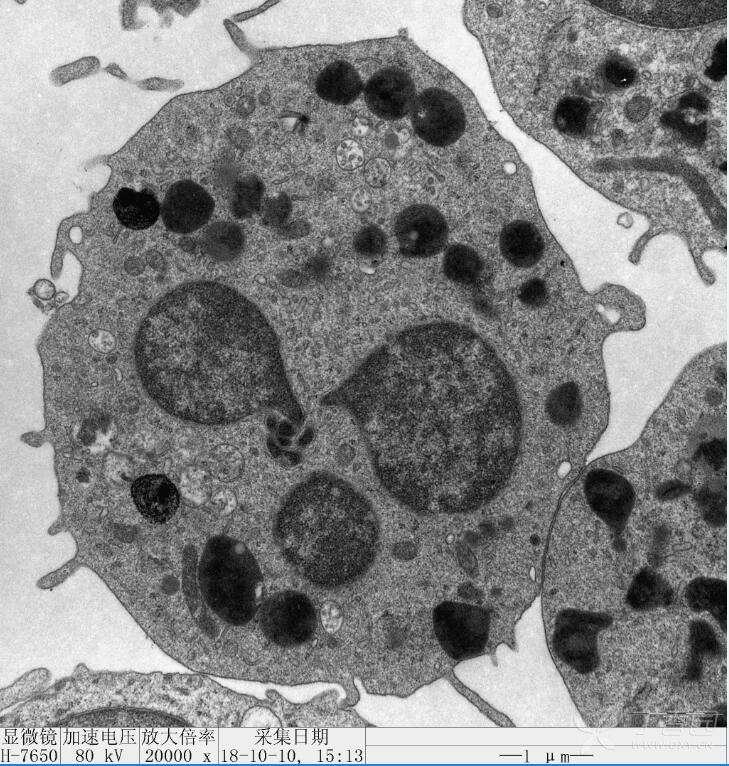 细胞电镜图透射电镜图片