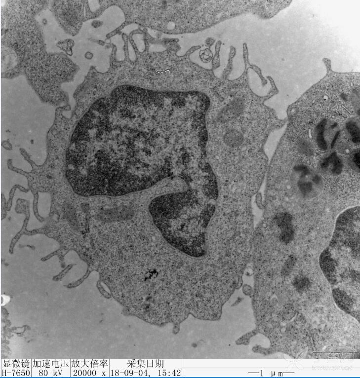 apoptosis小体图片
