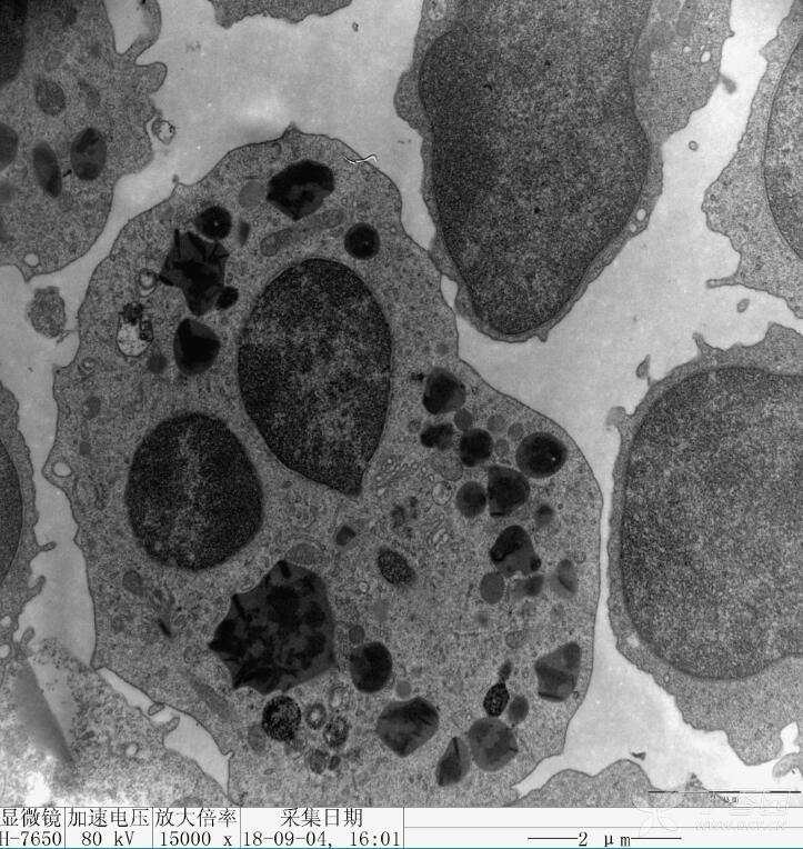 凋亡小体电镜图片图片