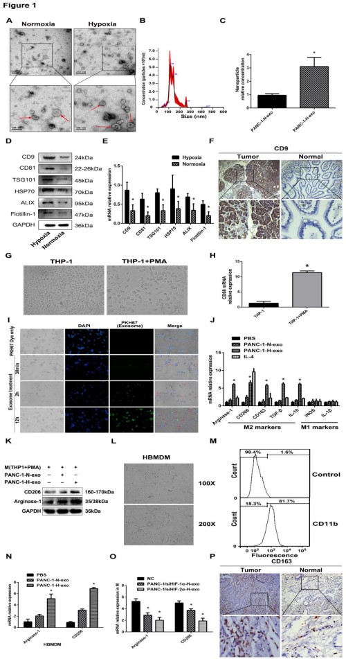 Cancer Research: 缺氧诱导的外泌体miRNA通过PTEN /PI3Kγ介导M2巨噬细胞极化以促进胰腺癌转移