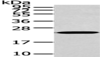 Anti-ARL2 antibody