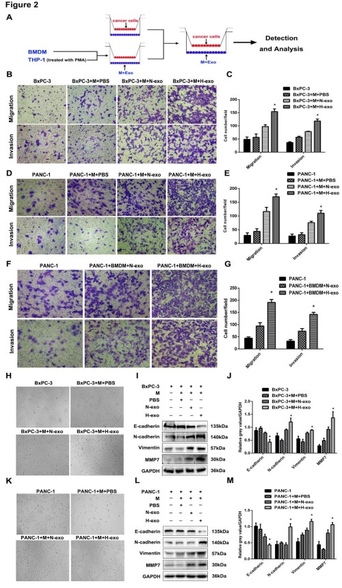 Cancer Research: 缺氧诱导的外泌体miRNA通过PTEN /PI3Kγ介导M2巨噬细胞极化以促进胰腺癌转移