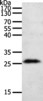  Anti-NGF antibody