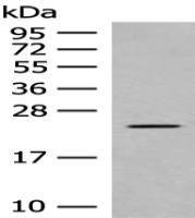 Anti-CLEC3B antibody