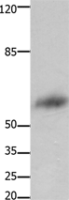 Anti-FOXJ3 antibody