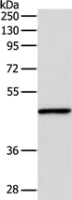 Anti-INHBA antibody