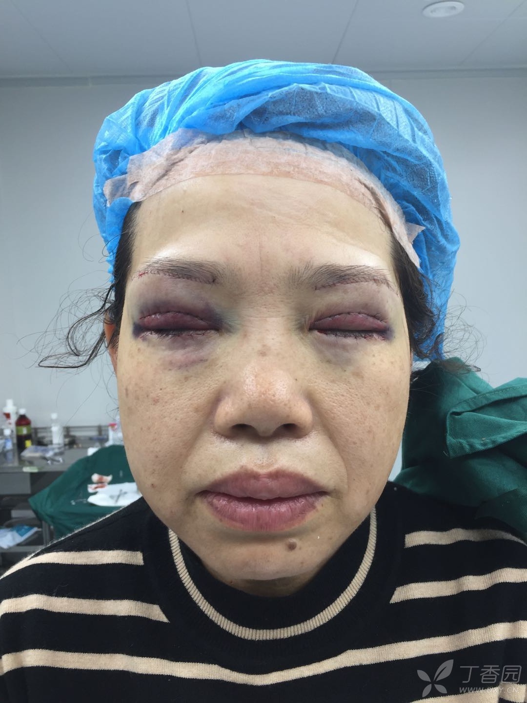 【讨论】一例富有挑战的眼部手术 [病例帖]