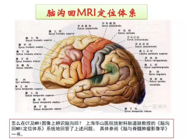 如何在 CT 及 MRI 图像上辨识脑沟回