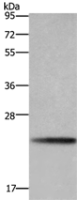 Anti-BBC3 antibody