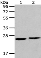Anti-HMGB2 antibody