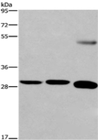 Anti-FGF8 antibody