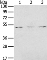 Anti-FOXG1 antibody