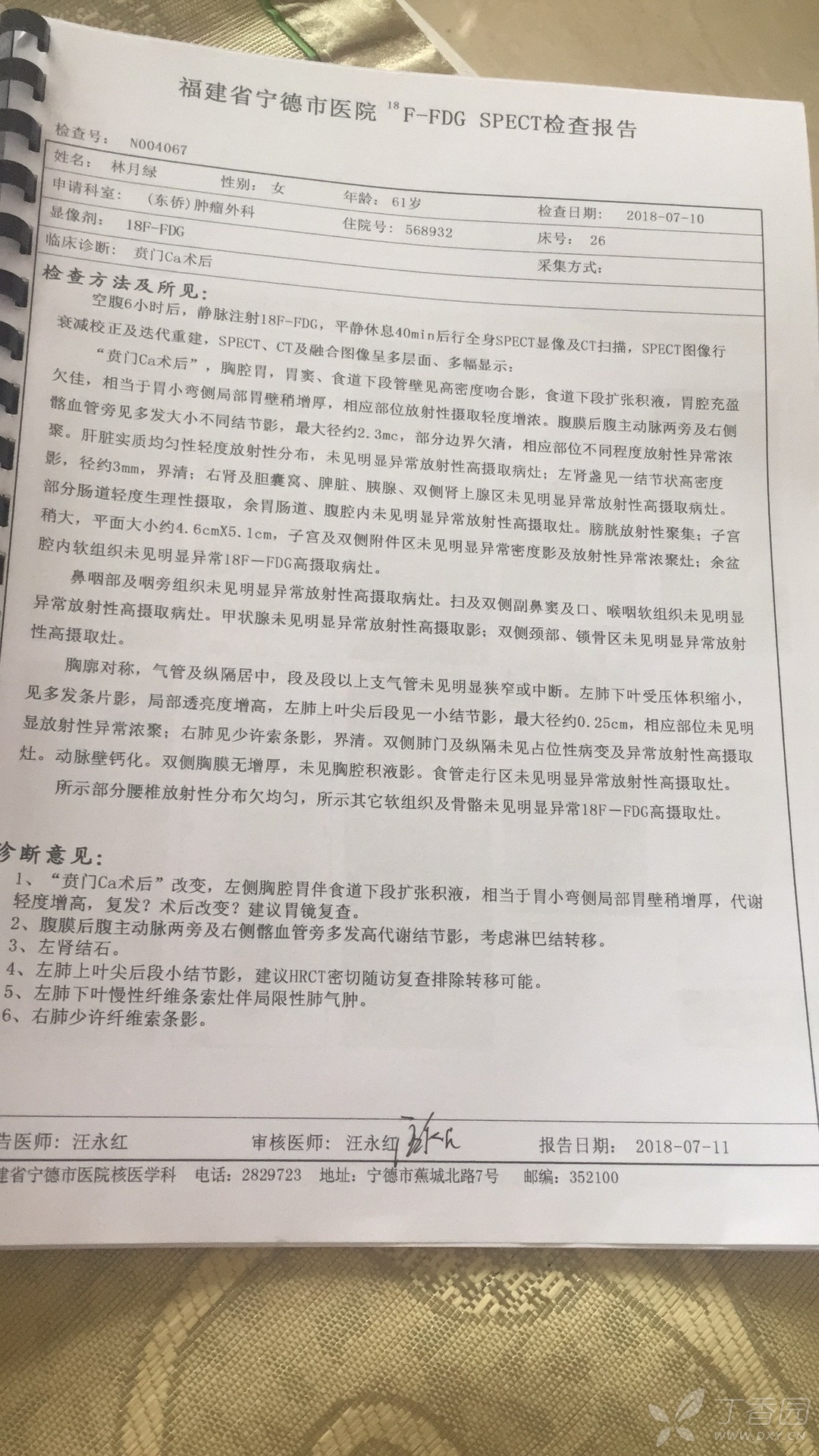 贲门癌术后图片