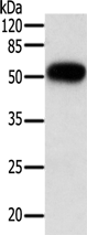 Anti-TNFRSF10B antibody产品图