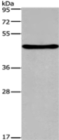 Anti-FOXA2 antibody