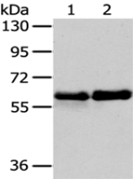 Anti-PAK3 antibody