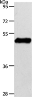 Anti-S1PR1 antibody
