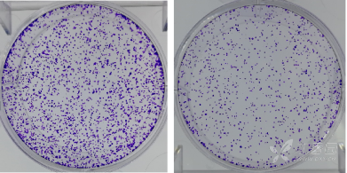 然后去固定液,加适量giemsa应用染色液染10分钟
