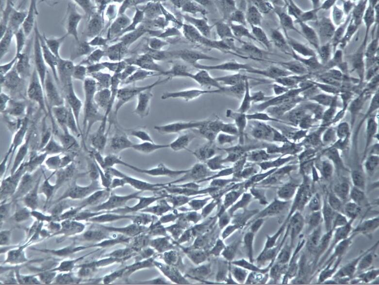永生化人脑微血管内皮细胞hCMEC/D3