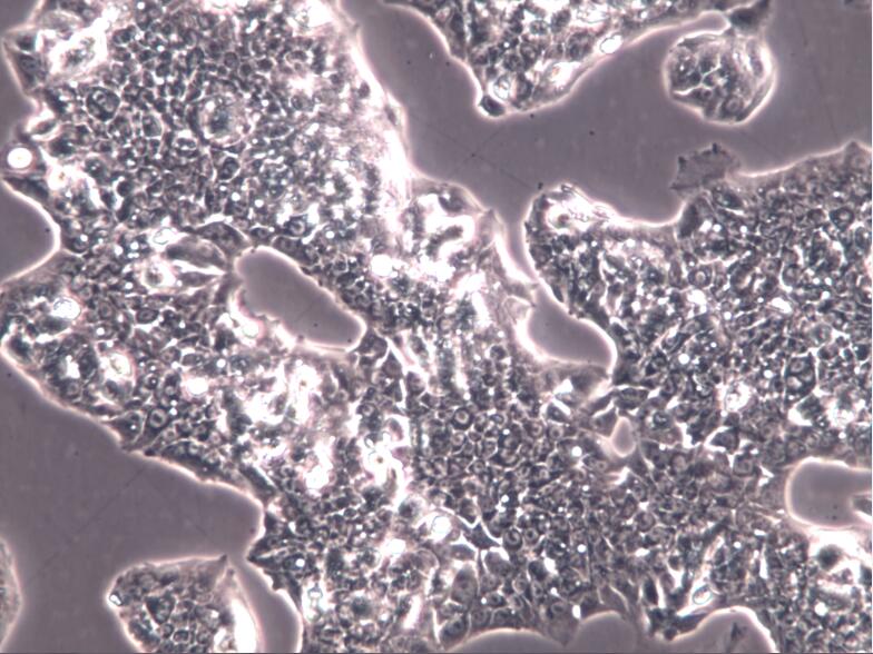HepG2细胞、HepG2细胞、HepG2肝癌细胞