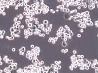 MDA-MB-453细胞、MDA-MB-453细胞、MDA-MB-453细胞