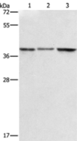 Anti-ZFP42 antibody