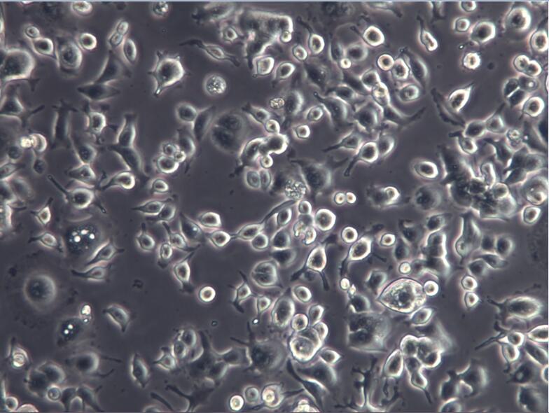 AsPC-1细胞、AsPC-1细胞、AsPC-1胰腺癌细胞