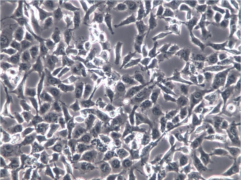 HTR-8人绒毛膜滋养细胞