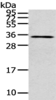 Anti-CLIC4 antibody