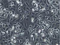 NCI-H1703、NCI-H1703细胞、NCI-H1703