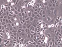 SAS 人舌鳞状癌细胞