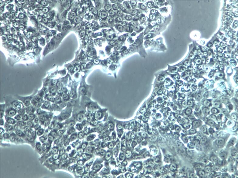 Capan1细胞、Capan1细胞、Capan1细胞