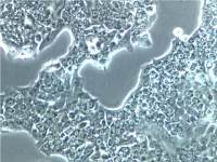 Capan1细胞、Capan1细胞、Capan1细胞