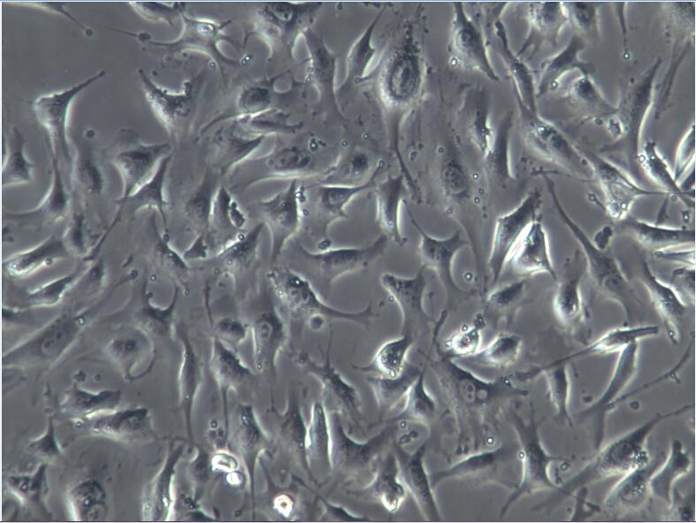 人脐静脉细胞融合细胞EA.hy926