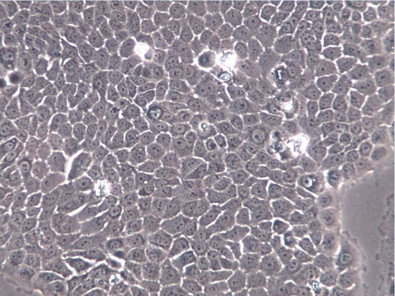 人原位胰腺腺癌细胞BxPC-3