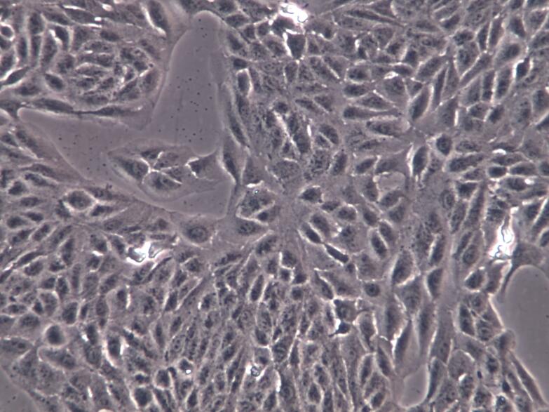 人视网膜色素上皮细胞ARPE-19
