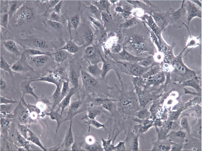 人SV40转染成骨细胞hFOB 1.19