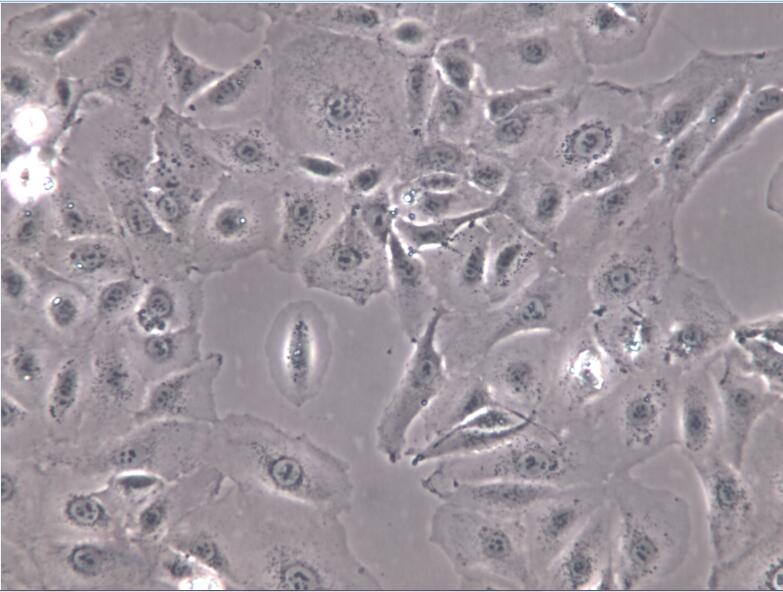 人胆管细胞型肝癌细胞HCCC-9810