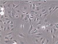 HCCC-9810细胞、HCCC-9810细胞、HCCC-9810细胞