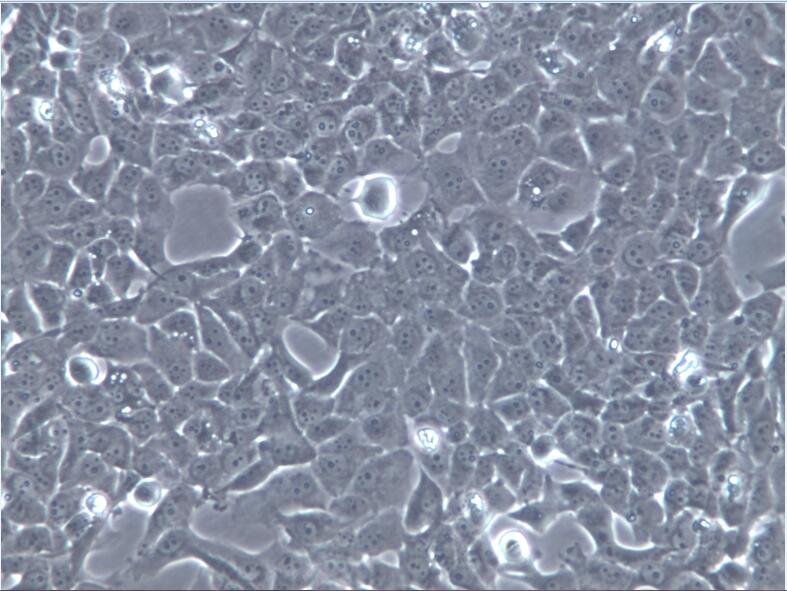 BCPAP 细胞、BCPAP 细胞、BCPAP 甲状腺癌细胞