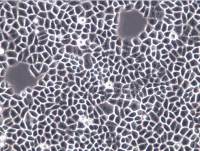 ECA109细胞、ECA109细胞、ECA-109细胞