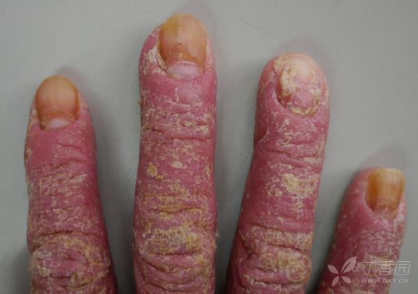 可能涉及到敏感图片,点击后可查看